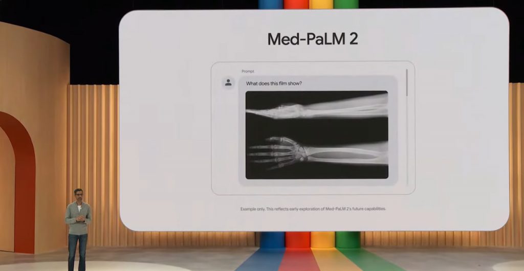Google Med-PaLM 2